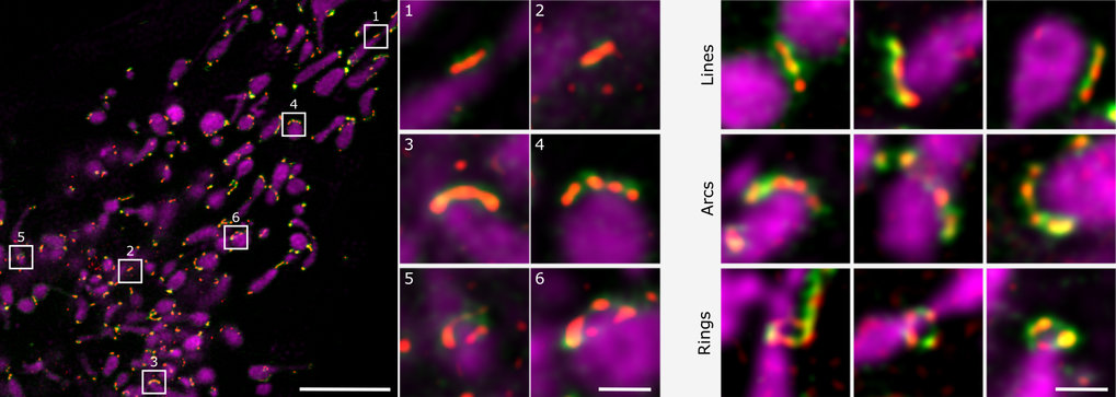 Ana J. García-Sáez – Membrane Dynamics